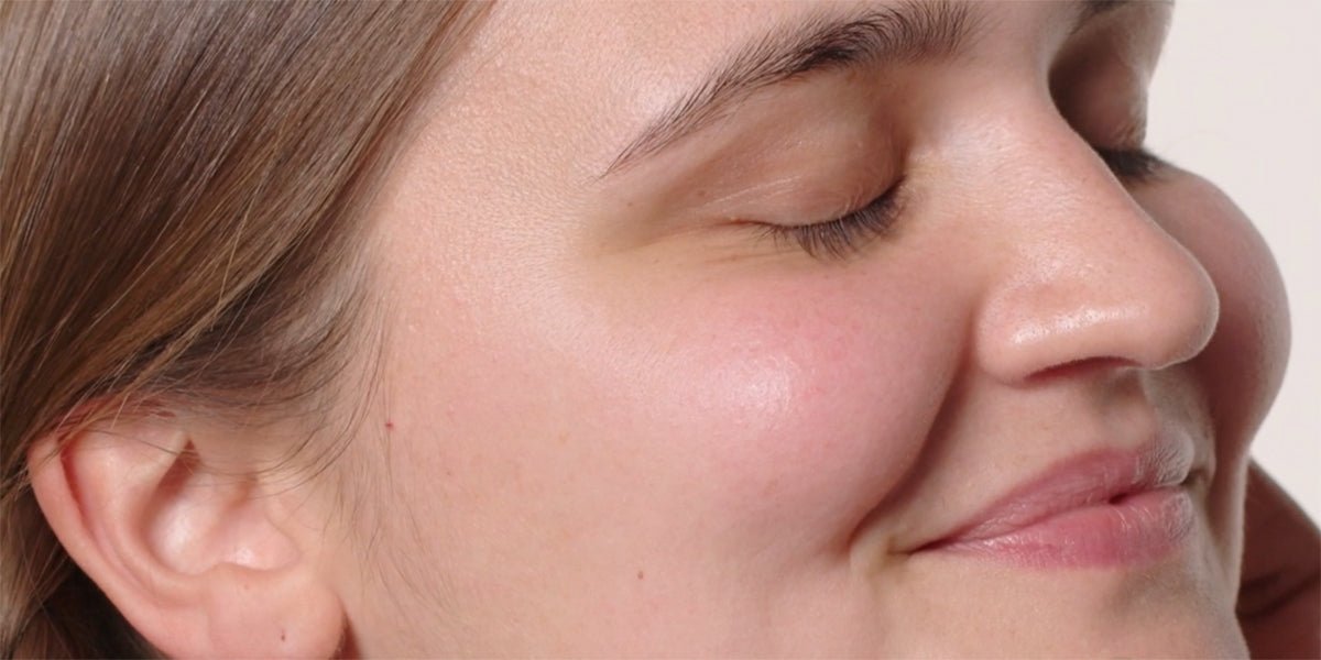 Näin hoidat atooppista ja ekseemaan taipuvaista ihoa - Dermalogica Suomi