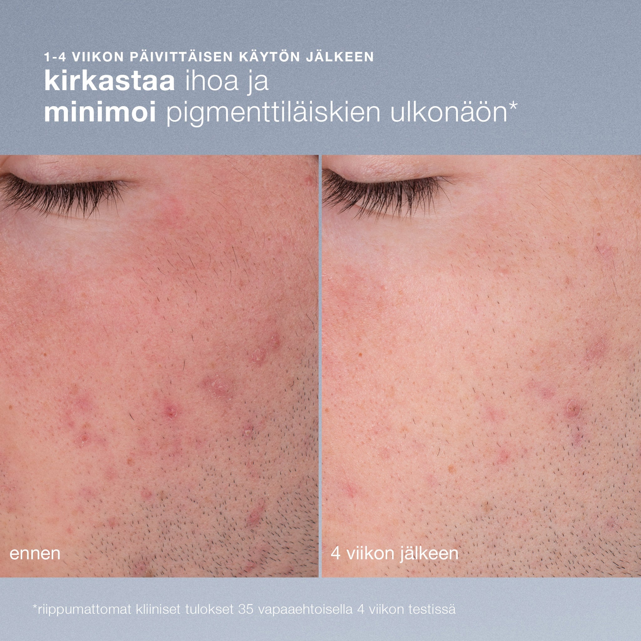 Daily Microfoliant - kuorinta - Dermalogica Suomi