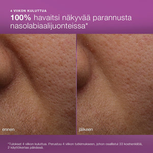 MultiVitamin Power Recovery Cream - kosteusvoide - Dermalogica Suomi
