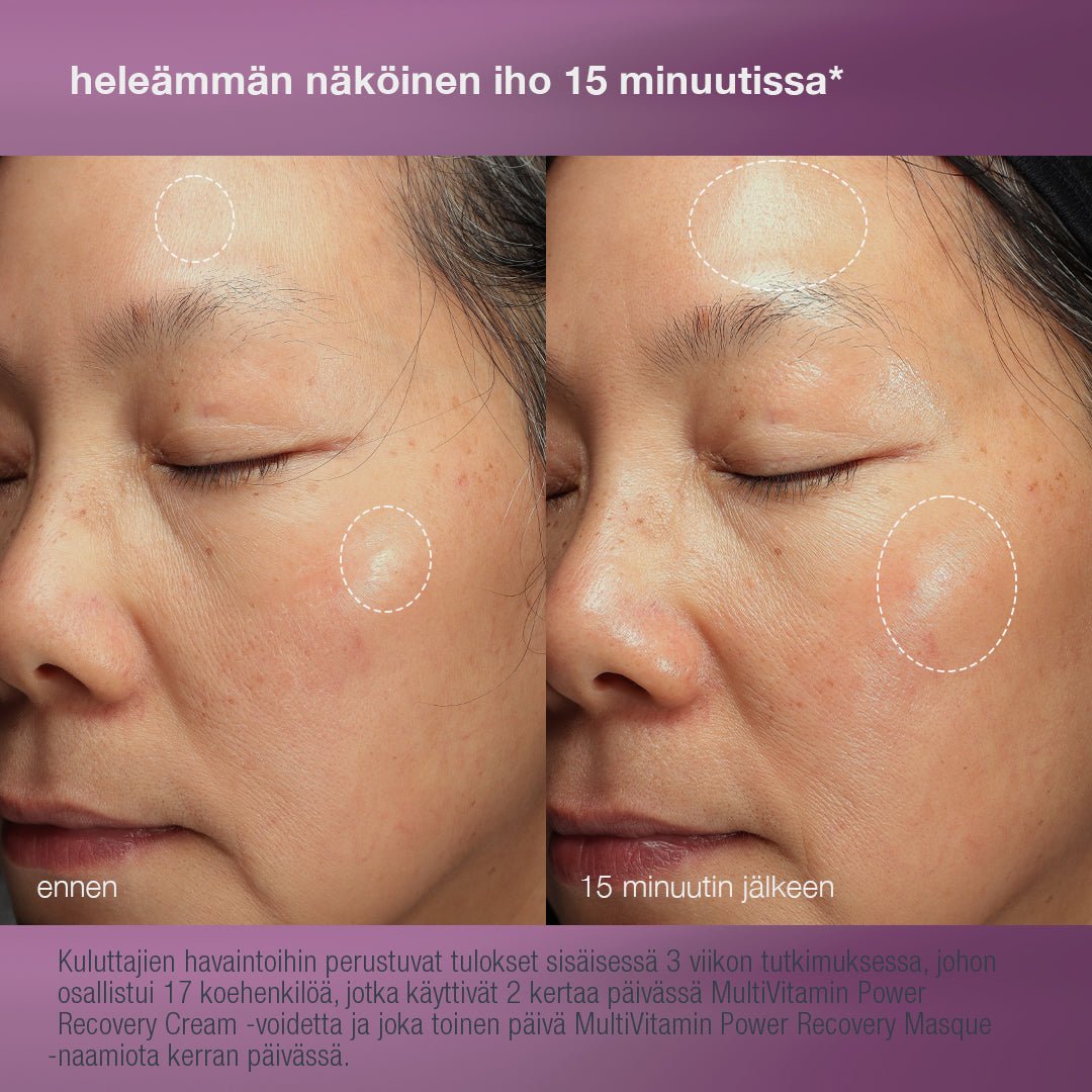 Stressed Skin Recovery System - ihonhoitosetti - Dermalogica Suomi